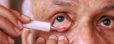Gels and Ointments Butterflies Eyecare Gels and Ointments Butterflies Eyecare